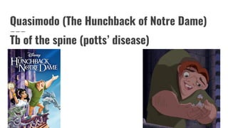 Quasimodo (The Hunchback of Notre Dame)
Tb of the spine (potts’ disease)
 