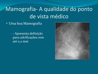 Mamografia- A qualidade do ponto
       de vista médico
 Uma boa Mamografia

   - Apresenta definição
   para calcificações com
   até 0,2 mm
 