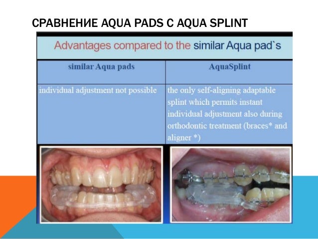 Aqua splint
