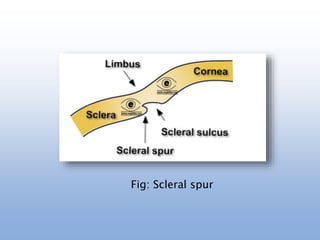 Fig: Scleral spur
 