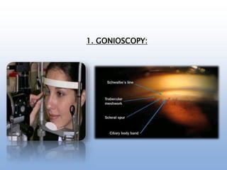 1. GONIOSCOPY:
 
