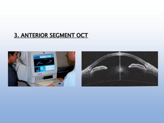 3. ANTERIOR SEGMENT OCT
 