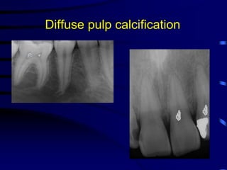 Acquired abnormalities of the jaws | PPT