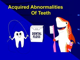 Acquired Abnormalities
Of Teeth
 