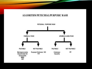 Rash Approach Algorithm Approach to a child with fever and rash | PPTX