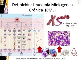 Definición: Leucemia Mielogenea
Crónica (CML)
Kaushansky K. Williams Hematology; 9th edition McGraw Hill; 2016
t(9:22)(q34:q11)
(Ph) - 95%
 