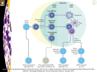 Kipps T. Chronic lymphocytic leukaemia. Nat Rev Dis Primers. 2017 Jan 19; 3: 16096. Kaushansky K. Williams Hematology; 9th edition McGraw Hill; 2016.
Hallek M. Hematologic Malignancies: Chronic lymphocytic leukemia. Springer; 2019.
 