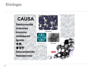 Etiologia 
