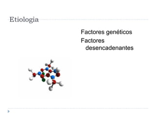 Etiologia Factores genéticosFactores desencadenantes
