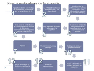 Rasgos particulares de la sinovitis1234567810121311