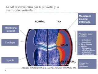 La AR se caracteriza por la sinovitis y ladestrucción articular:Membranasinovialinflamada                                             NORMAL                    AR                                                                               PANUS                                                                               LIQ. SINOVIALADELGASAMIENTO DE CARTILAGO                                Adaptado de Feldmann M, et al. Ann Rev Immunol. 1996;14:397-440Membrana sinovialPrincipales tiposde células:• linfocitos T• macrófagosOtros tipos decélulas:• fibroblastos• cél. plasmáticas• endoteliales• cél. dendríticasCartílagocapsulaPrincipal tipocelular:• neutrófilos