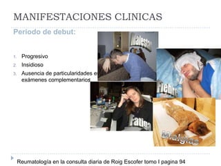 MANIFESTACIONES CLINICASPeriodo de debut:ProgresivoInsidioso Ausencia de particularidades en exámenes complementarios.MialgiasReumatología en la consulta diaria de Roig Escofer tomo I pagina 94