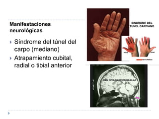 Manifestaciones neurológicasSíndrome del túnel del carpo (mediano)Atrapamiento cubital, radial o tibial anterior