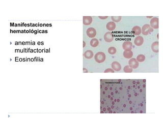 Manifestaciones hematológicasanemia es multifactorialEosinofilia