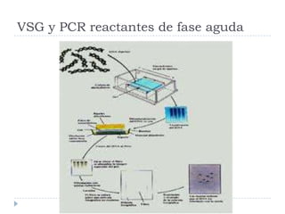 VSG y PCR reactantes de fase aguda