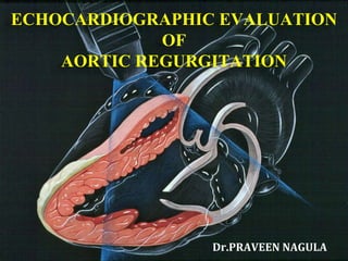 ECHOCARDIOGRAPHIC EVALUATION
OF
AORTIC REGURGITATION
Dr.PRAVEEN NAGULA
 