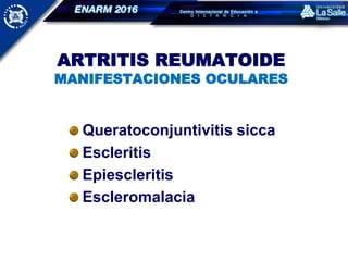 ARTRITIS REUMATOIDE
MANIFESTACIONES OCULARES
Queratoconjuntivitis sicca
Escleritis
Epiescleritis
Escleromalacia
 