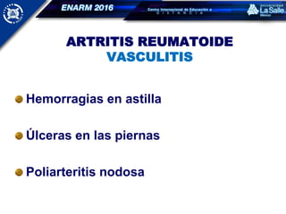 ARTRITIS REUMATOIDE
VASCULITIS
Hemorragias en astilla
Úlceras en las piernas
Poliarteritis nodosa
 