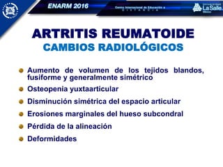 ARTRITIS REUMATOIDE
CAMBIOS RADIOLÓGICOS
Aumento de volumen de los tejidos blandos,
fusiforme y generalmente simétrico
Osteopenia yuxtaarticular
Disminución simétrica del espacio articular
Erosiones marginales del hueso subcondral
Pérdida de la alineación
Deformidades
 
