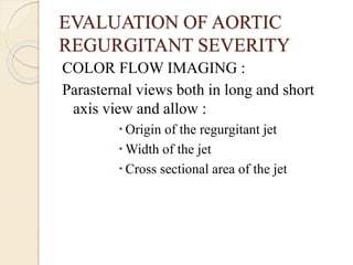 EVALUATION OF AORTIC
REGURGITANT SEVERITY
COLOR FLOW IMAGING :
Parasternal views both in long and short
axis view and allow :
 Origin of the regurgitant jet
 Width of the jet
 Cross sectional area of the jet
 
