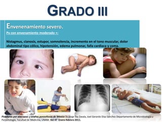 GRADO III
Envenenamiento severo.
Px con envenamiento moderado +:
Nistagmus, cianosis, estupor, somnolencia, incremento en el tono muscular, dolor
abdominal tipo cólico, hipotensión, edema pulmonar, falla cardiaca y coma.
Picaduras por alacranes y arañas ponzoñosas de México Dr.Jorge Tay Zavala, Joel Gerardo Díaz Sánchez Departamento de Microbiología y
Parasitología, Facultad de Medicina, UNAM. Vol 47 Enero-febrero 2011.
 