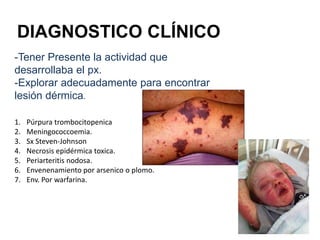 DIAGNOSTICO CLÍNICO
-Tener Presente la actividad que
desarrollaba el px.
-Explorar adecuadamente para encontrar
lesión dérmica.
1. Púrpura trombocitopenica
2. Meningococcoemia.
3. Sx Steven-Johnson
4. Necrosis epidérmica toxica.
5. Periarteritis nodosa.
6. Envenenamiento por arsenico o plomo.
7. Env. Por warfarina.
 