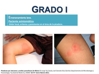 GRADO I
Paciente asintomático.
-Dolor local, eritema y parestesias en el área de la picadura.
Picaduras por alacranes y arañas ponzoñosas de México Dr.Jorge Tay Zavala, Joel Gerardo Díaz Sánchez Departamento de Microbiología y
Parasitología, Facultad de Medicina, UNAM. Vol 47 Enero-febrero 2011.
 