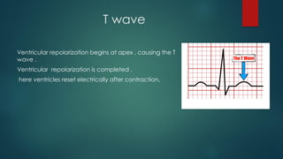 T wave
Ventricular repolarization begins at apex , causing the T
wave .
Ventricular repolarization is completed .
here ventricles reset electrically after contraction.
 