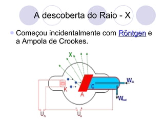 A descoberta do Raio - X Começou incidentalmente com  Röntgen  e a Ampola de Crookes. 