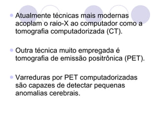 Atualmente técnicas mais modernas acoplam o raio-X ao computador como a tomografia computadorizada (CT). Outra técnica muito empregada é tomografia de emissão positrônica (PET). Varreduras por PET computadorizadas são capazes de detectar pequenas anomalias cerebrais. 