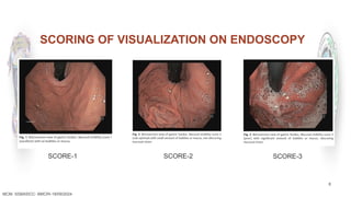 8
SCORING OF VISUALIZATION ON ENDOSCOPY
MCM- SSBASICC- BMCRI-18/09/2024
SCORE-1 SCORE-2 SCORE-3
 