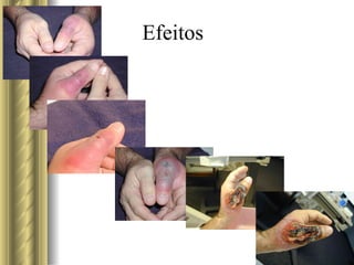 Efeitos 