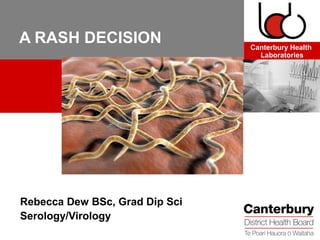 A RASH DECISION                 Canterbury Health
                                  Laboratories




Rebecca Dew BSc, Grad Dip Sci
Serology/Virology
 