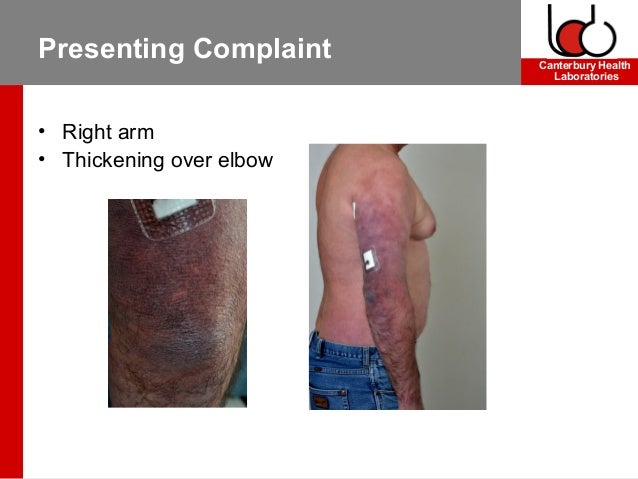 Case study on skin disorders picture