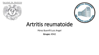 Artritis reumatoide
Pérez Buenfil Luis Angel
Grupo: 4942
 