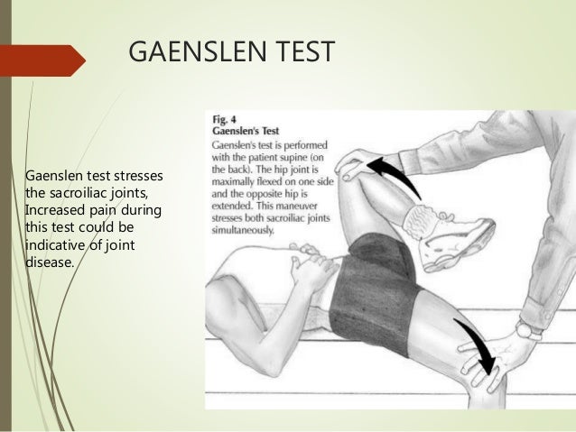 ANKYLOSING SPONDYLITIS physiotherapy ppt