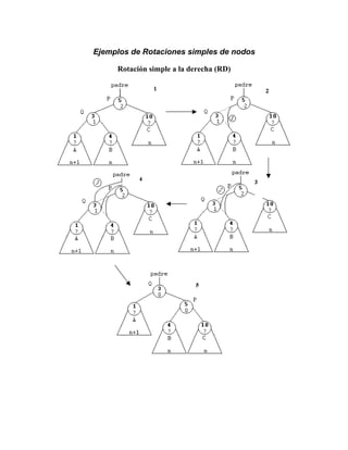 Ejemplos de Rotaciones simples de nodos
Rotación simple a la derecha (RD)
 
