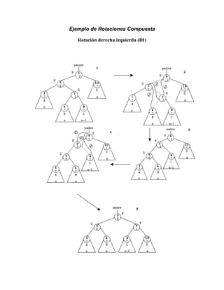 Ejemplo de Rotaciones Compuesta
Rotación derecha izquierda (DI)
 