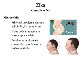 Microcefalia
Principal problema causado
pela infecção intrauterina
Vírus pode ultrapassar a
barreira placentária
Problemas intelectuais,
convulsões, problemas de
visão e audição
Zika
Complicações
 