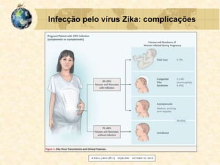 Infecção pelo vírus Zika: complicações
 