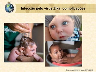 Infecção pelo vírus Zika: complicações
Science vol 351(11), issue 6278, 2016
 