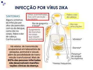 INFECÇÃO POR VÍRUS ZIKA
 