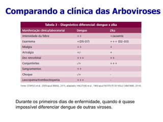 Comparando a clínica das Arboviroses
Durante os primeiros dias de enfermidade, quando é quase
impossível diferenciar dengue de outras viroses.
 