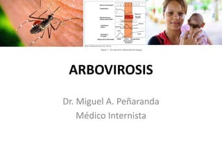 ARBOVIROSIS
Dr. Miguel A. Peñaranda
Médico Internista
 