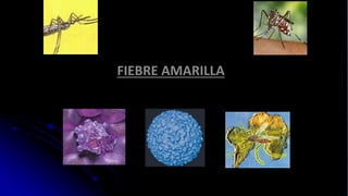 FIEBRE AMARILLA
 