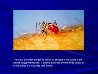 The most common epidemic vector of dengue in the world is the
Aedes aegypti mosquito. It can be identified by the white bands or
scale patterns on its legs and thorax.
 