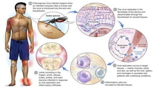 Arbo viruse classification and their diseases | PPTX