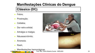  Febre;
 Prostração;
 Cefaléia;
 Dor retro-orbital;
 Artralgia e mialgia;
 Náuseas/vômito;
 Anorexia;
 Rash;
 Manifestações hemorrágicas.
Rash
Manifestações Clínicas do Dengue
Clássico (DC)
14/03/2016 Prof. MSc. Clovis Roberto Gurski - BIÓLOGO 24
 