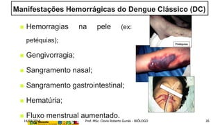  Hemorragias na pele (ex:
petéquias);
 Gengivorragia;
 Sangramento nasal;
 Sangramento gastrointestinal;
 Hematúria;
 Fluxo menstrual aumentado.
Petéquias
Manifestações Hemorrágicas do Dengue Clássico (DC)
14/03/2016 Prof. MSc. Clovis Roberto Gurski - BIÓLOGO 26
 