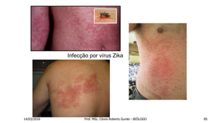 Infecção por vírus Zika
14/03/2016 Prof. MSc. Clovis Roberto Gurski - BIÓLOGO 85
 